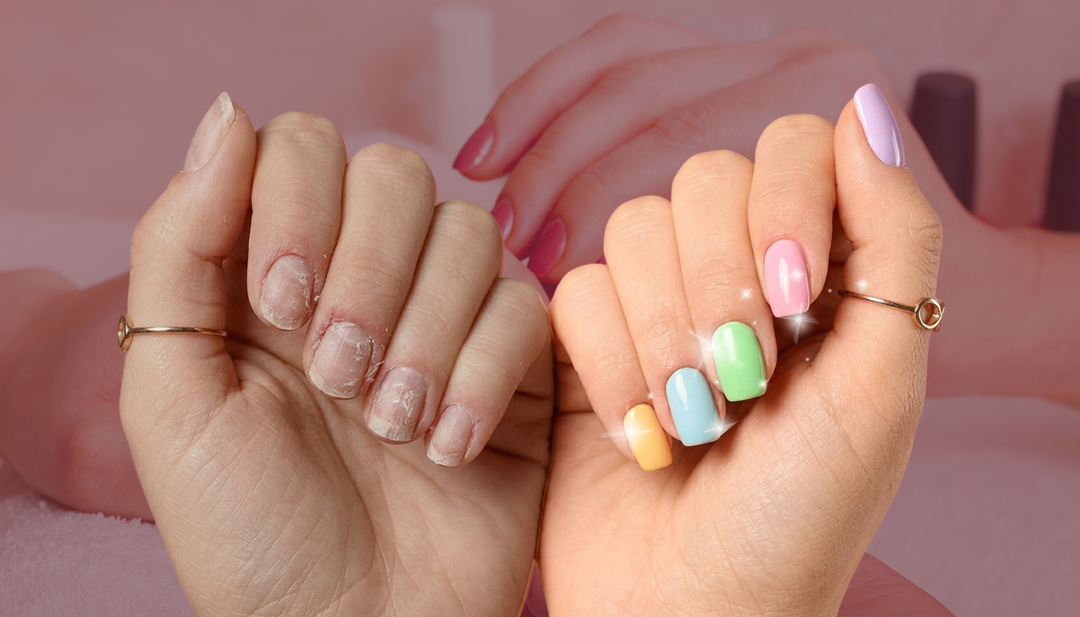 does gel damage my nails? 